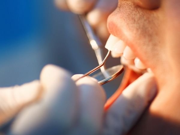 Urgencias dentales